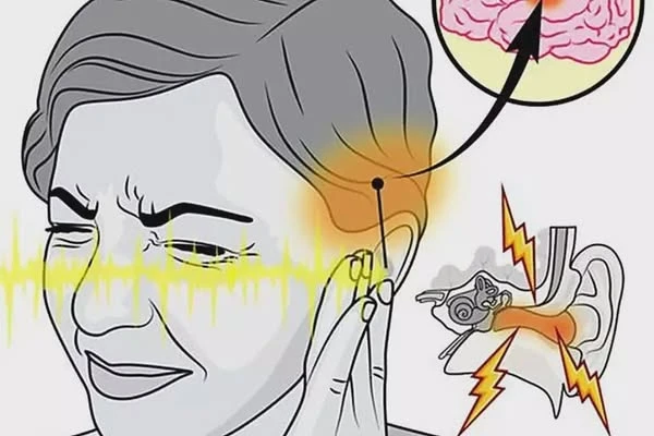 Watch the neurological explanation